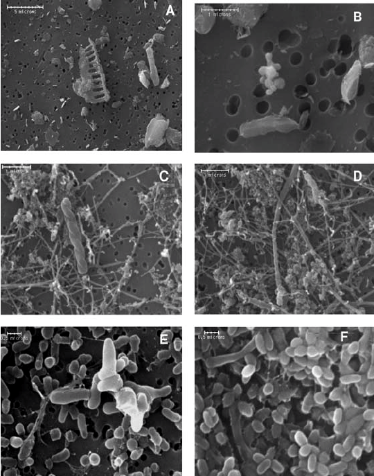 Bacteria recovered from deep inside the Greenland inland ice