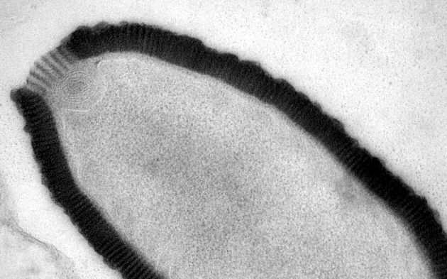  A 30000-year-old giant virus